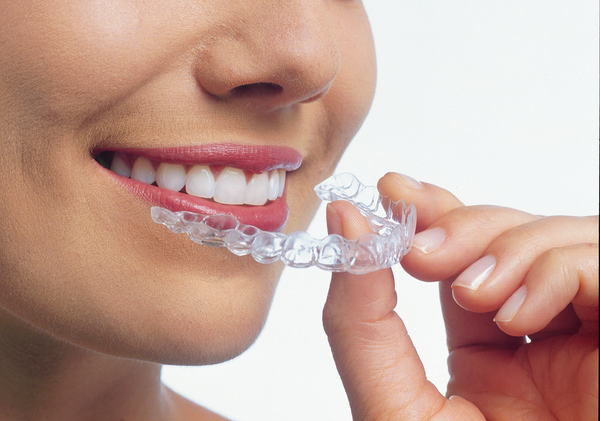 invisalign