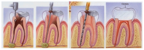 Endodontists