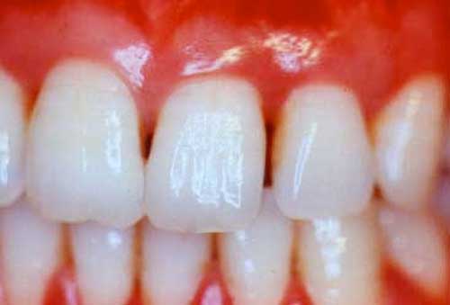 Diş Hekimi Kontrolleri ile Diş Hastalıklarına ve Çürüklere Erken Teşhis
